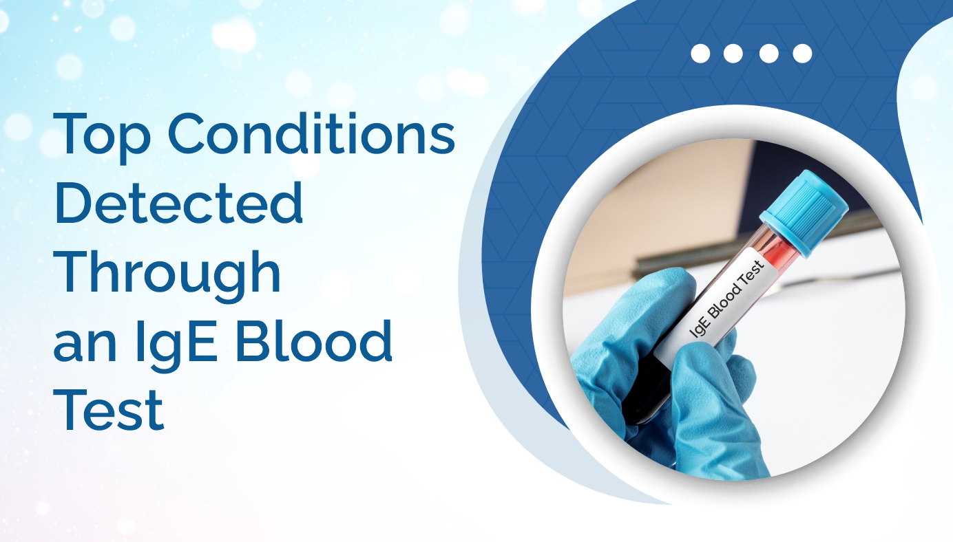 Top Conditions Detected Through an IgE Blood Test